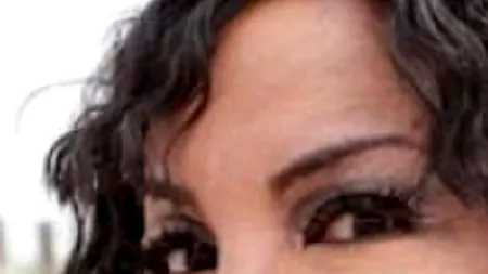 Cum arată femeia care și-a injectat ciment și lipici în pomeți, pentru a deveni mai frumoasă