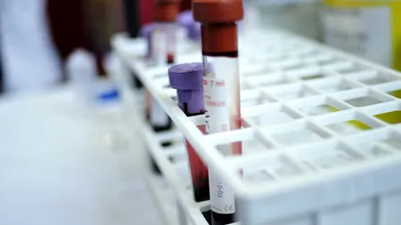 Dosar penal în cazul eprubetelor cu sânge găsite pe Drumul Național 14