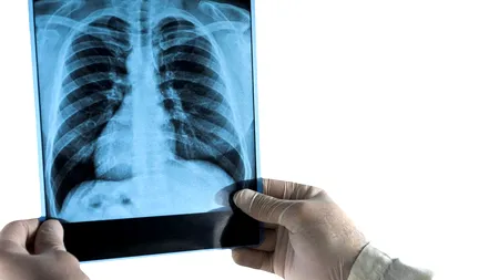 Focar misterios de pneumonie într-un oraș din Argentina. A fost identificată bacteria care a ucis șase oameni într-o săptămână