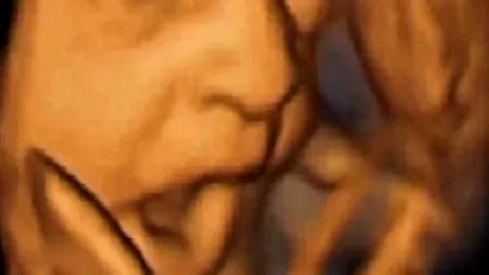 Ecografia care face înconjurul lumii. Ce face acest făt în burta mamei lui. VIDEO