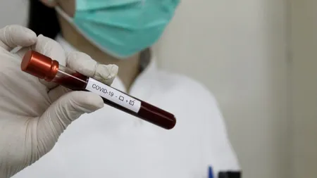 Studiu: Coronavirusul a apărut în Italia mai devreme decât se credea