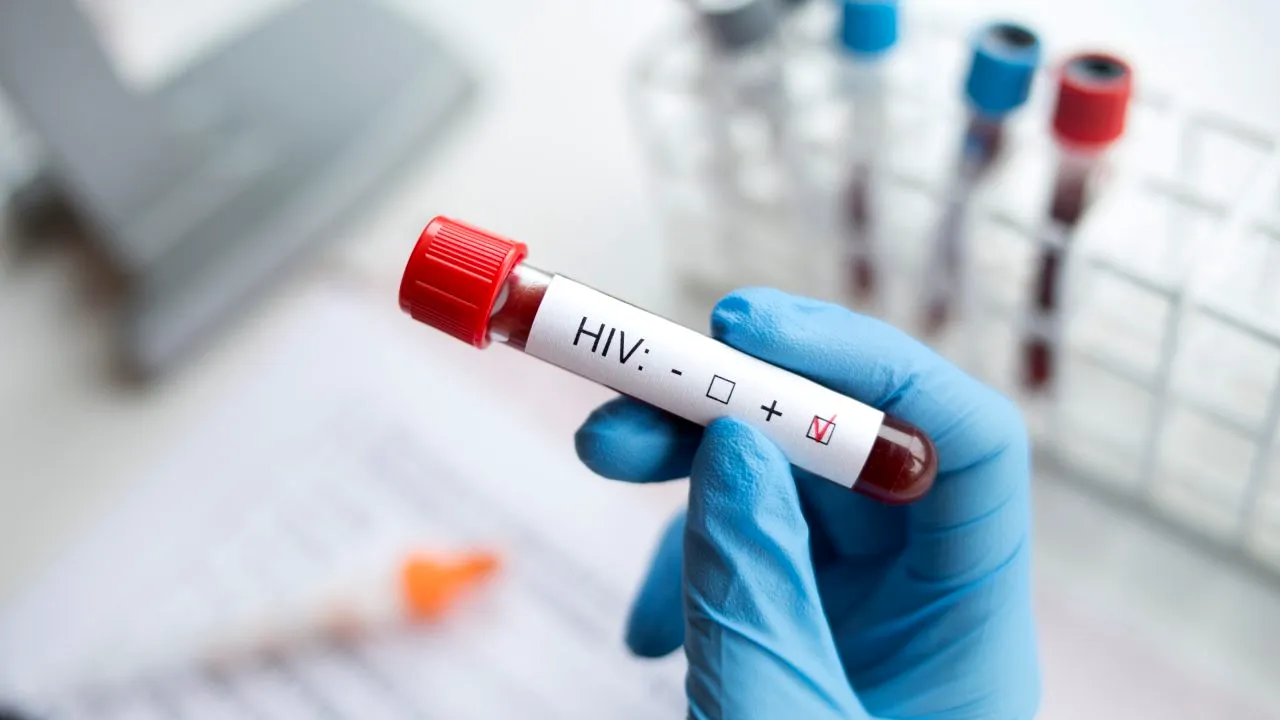 Un bărbat s-a vindecat de HIV după ce a primit tratament pentru leucemie. Medicii spun că e doar al patrulea caz de acest fel