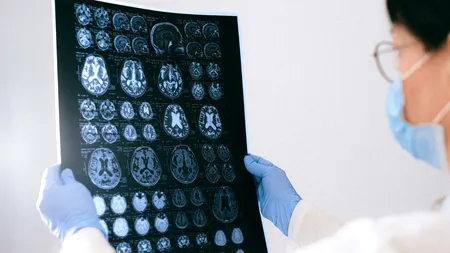 Sute de copii cu epilepsie, uitați de statul român