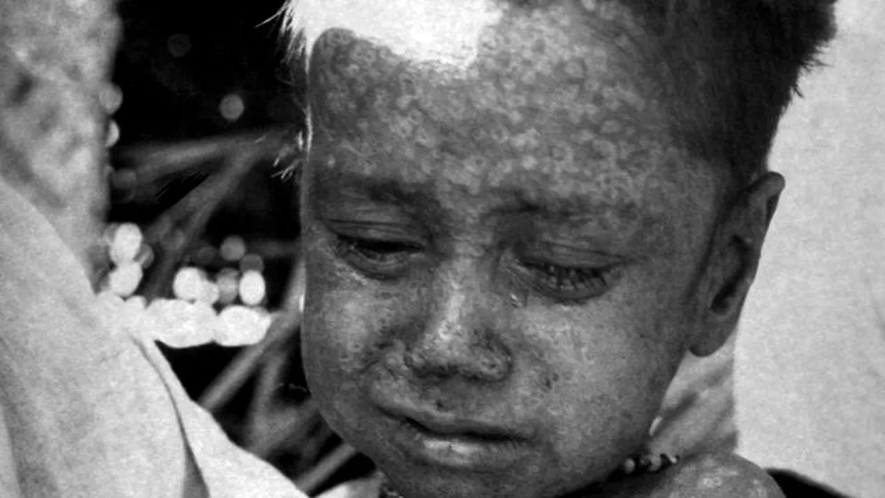 Un virus care ar fi omorât 500 de milioane de oameni ar fi apărut cu 1.000 de ani mai devreme decât se estimase / Ce ne spune asta despre coronavirus - FOTO