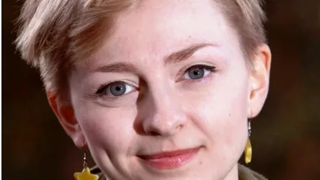 VIDEO. Povestea impresionantă a unei britanice care și-a smuls părul din cap până a rămas cheală