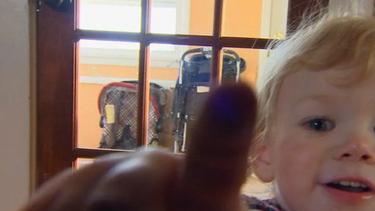 Afecțiunea extrem de rară care rămâne un mister pentru medici. Doar 1 din 70 de milioane de oameni suferă de această boală, iar Ivy este cel mai tânăr pacient