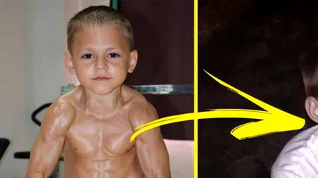 Ireal ce s-a ales de „Micul Hercule”. Cum arată la 18 ani, ce s-a întâmplat cu mușchii lui și ce a scris presa engleză despre el, acum