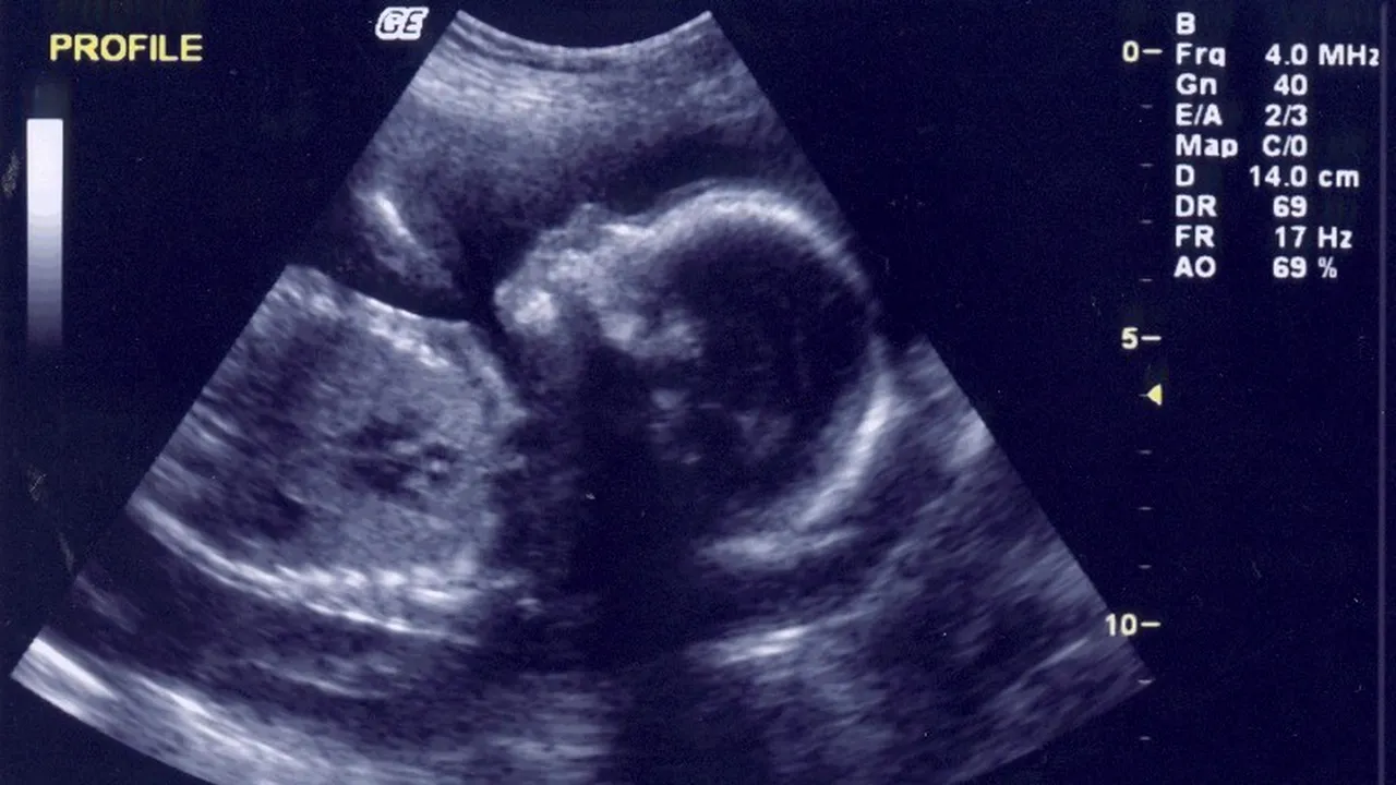 Cum a fost întâmpinat de familie bebelușul născut fără picioare