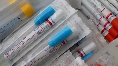 De ce unele teste Covid-19 ies pozitive, deși pacienții sunt vindecați. Explicațiile epidemiologilor