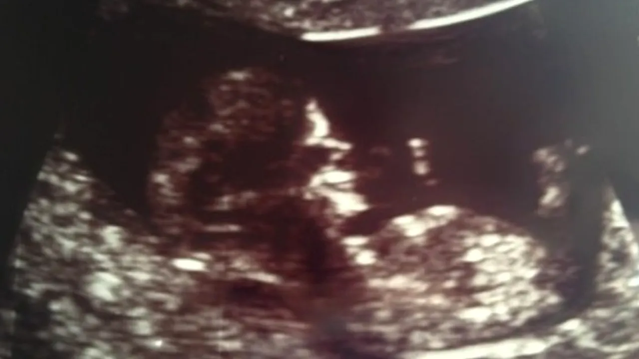 Ce l-a determinat pe un tată să publice ecografia cu viitorul său copil