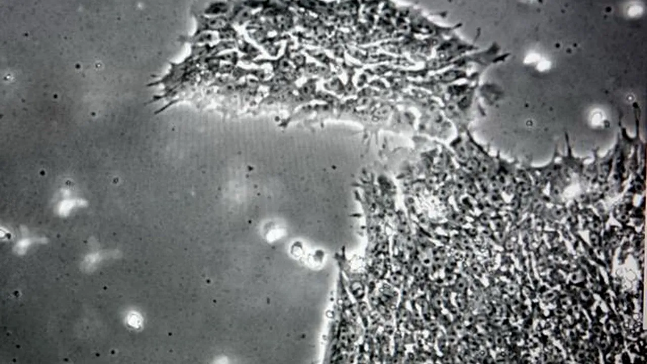 Cercetătorii au descoperit un virus care îi face pe oameni mai proști