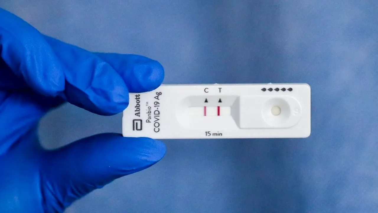 Franța anunță 551 de noi decese provocate de COVID-19 în ultimele 24 de ore, un record pentru cel de-al doilea val al epidemiei