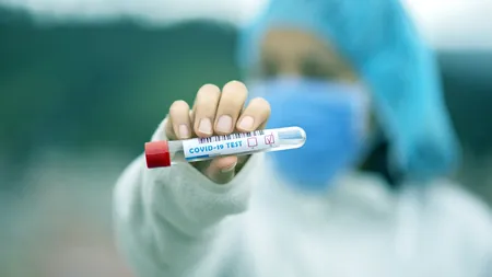 Rata de infectare în București a scăzut sub 14 la mie
