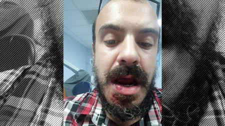 Bărbat bătut de un șofer STB. Victima făcuse scandal pentru că, în autobuz, nu funcționa aerul condiționat (VIDEO)