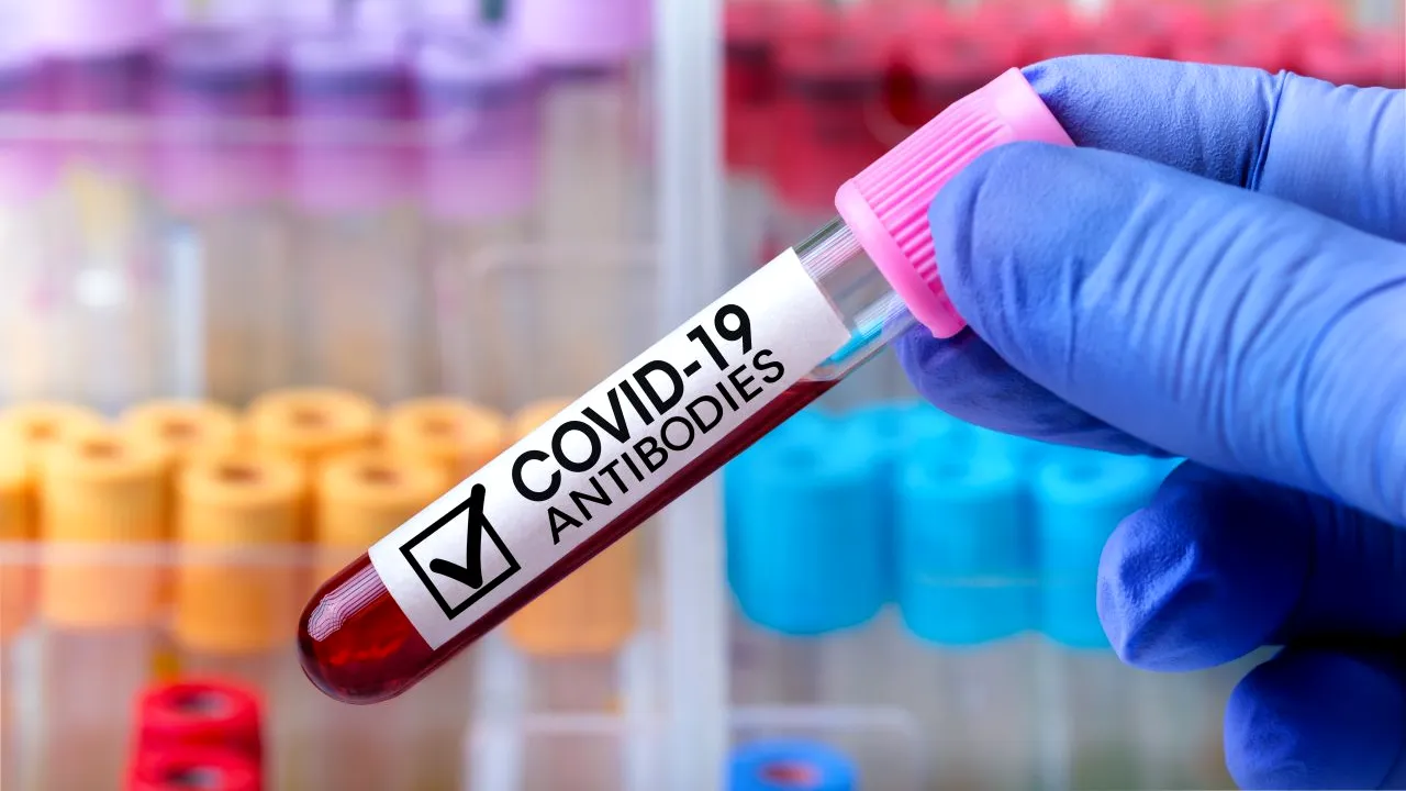 Coronavirus în România. Bilanț 16 aprilie 2021: 3.264 cazuri noi de persoane infectate cu SARS-CoV-2. Numărul de decese scade