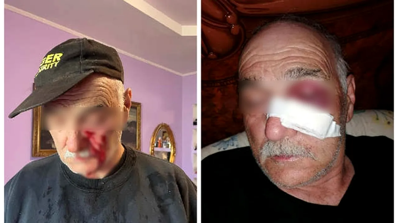 Caz șocant în Timiș. Un VÂRSTNIC a ajuns la spital, după ce a fost bătut fără milă de un adolescent care îi făcea avansuri nepoatei sale