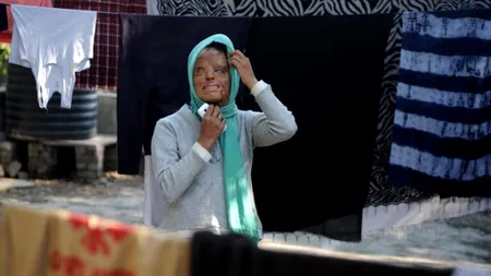 O femeie desfigurată în urma unui atac cu acid a câștigat un popular concurs de televiziune în India