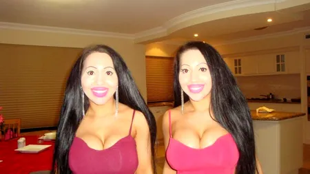 Au cheltuit 200.000 de dolari pentru a arăta identic. Împart totul, chiar și iubitul