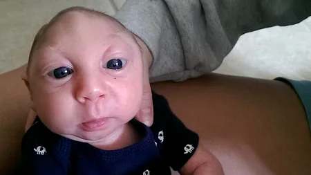 Cazul copilului care s-a născut fără o mare parte din creier și craniu. Medicii se așteptau să moară după câteva săptămâni, dar Jaxon a împlinit un an