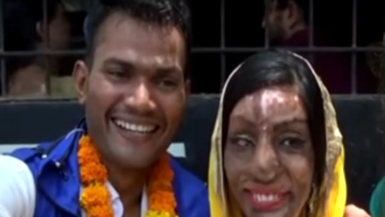 Victima unui atac cu acid și-a găsit marea dragoste după ce a format greșit un număr de telefon. A fost iubire de la prima conversație