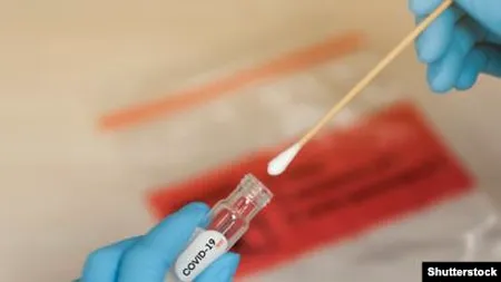 Numărul cazurilor de îmbolnăvire cu coronavirus rămâne ridicat. În ultimele 24 de ore, au fost înregistrate alte 413 noi cazuri de îmbolnăvire din 6.655 de teste efectuate/ La nivel național, au fost prelucrate 854.241 de teste