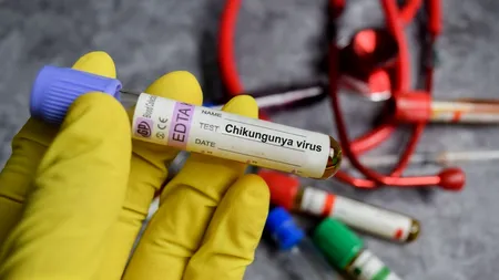 Alertă sanitară în New York. Prezența unui nou VIRUS a fost confirmată de autorități. Cum se transmite și care sunt simptomele