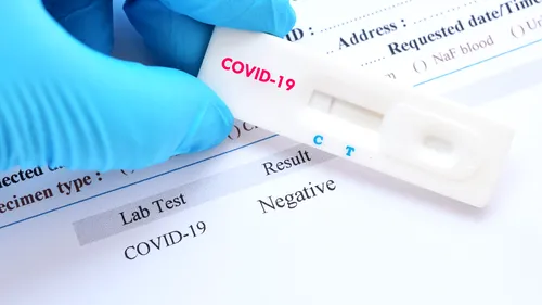 De ce sunt multe cazuri de COVID-19 în weekend, deși se fac mai puține teste. Explicațiile specialiștilor