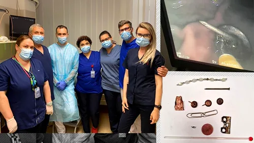FOTO | Caz incredibil la Suceava. Medicii au scos din stomacul unui pacient pioneze, cuie, o parte dintr-o balama de ușă, un termometru cu mercur și o brățară