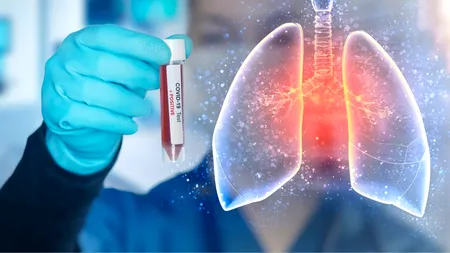 Studiu: Pneumonia COVID-19 este mai mortală deoarece se răspândește ca „focul”
