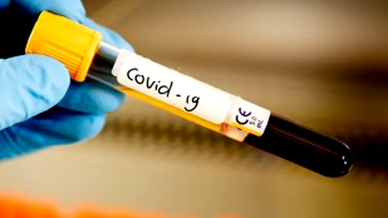CREȘTERE EXPLOZIVĂ FĂRĂ PRECEDENT. În ultimele 24 de ore, au fost raportate 777 de noi cazuri de infectări cu coronavirus. În Municipiul București a fost raportat cel mai mare număr de cazuri de coronavirus în ultimele 24 de ore