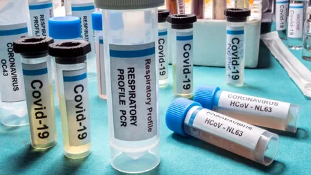 DEZVĂLUIRE. Gigi Becali are leacul pentru Covid-19! Destăinuire șocantă făcută de „Războinicul luminii”