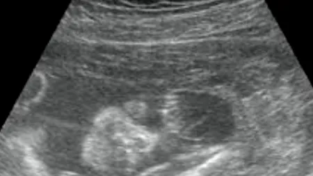 O astfel de mamă la 200 de milioane. 