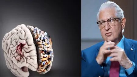 Cele 3 obiceiuri zilnice care ne distrug creierul, potrivit dr. Vlad Ciurea