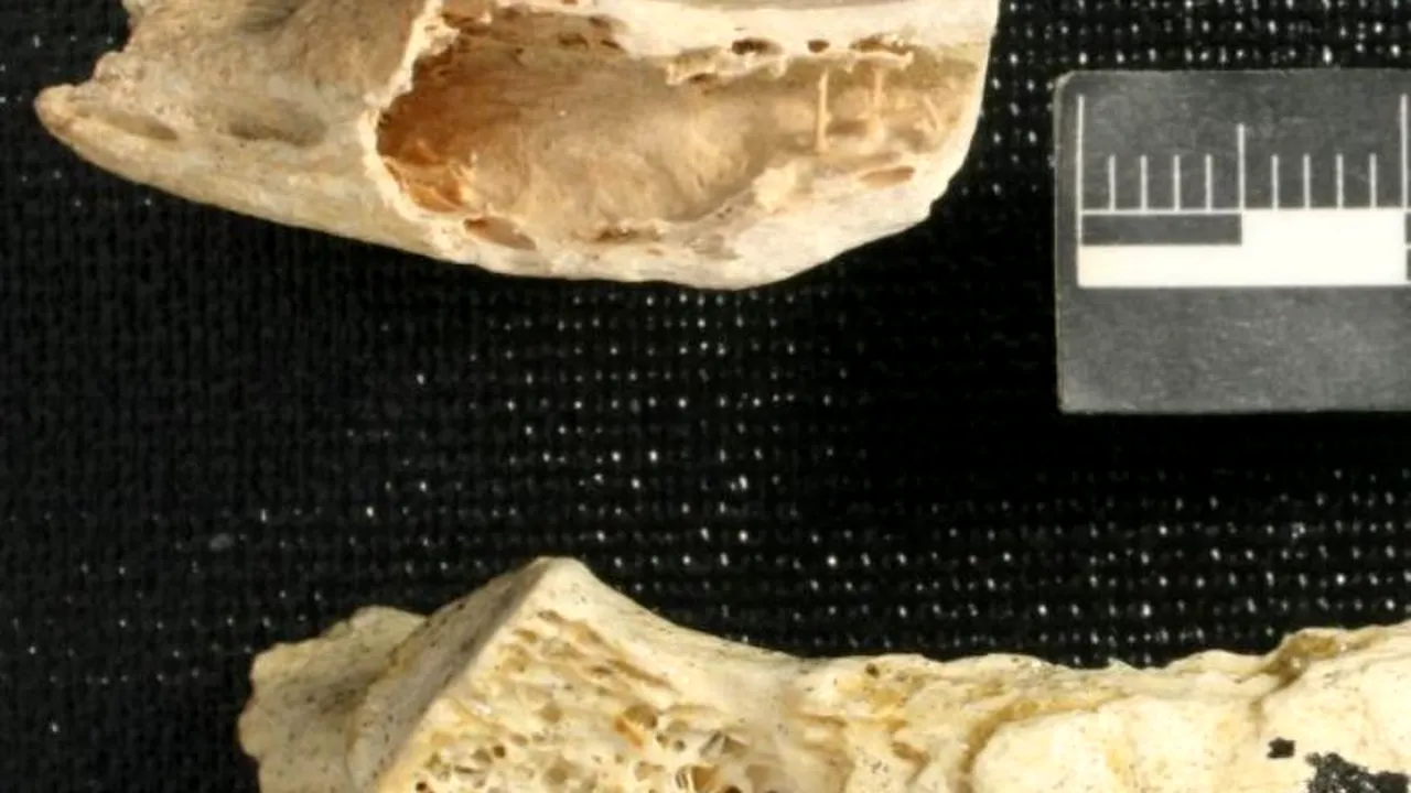 A fost descoperită cea mai veche tumoare