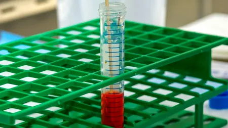 Bilanț Covid în România, 17 iulie 2021: 49 de cazuri şi 2 decese, în ultimele 24 de ore