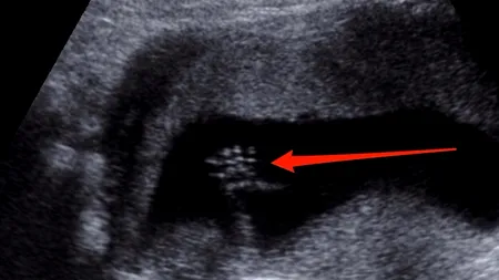 Oamenii de știință au făcut o descoperire „șocantă