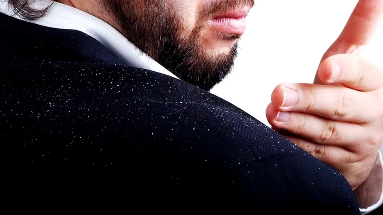 Cum să scapi rapid de mătreață