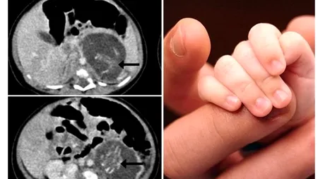 Cazul unui bebeluș care a șocat lumea medicală din Hong Kong: S-a născut „însărcinată