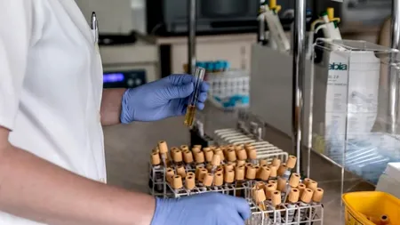 STUDIU. Persoanele cu grupa de sânge A (II) sunt mai predispuse la infectarea cu Covid-19. Cele cu O (I), mai rezistente