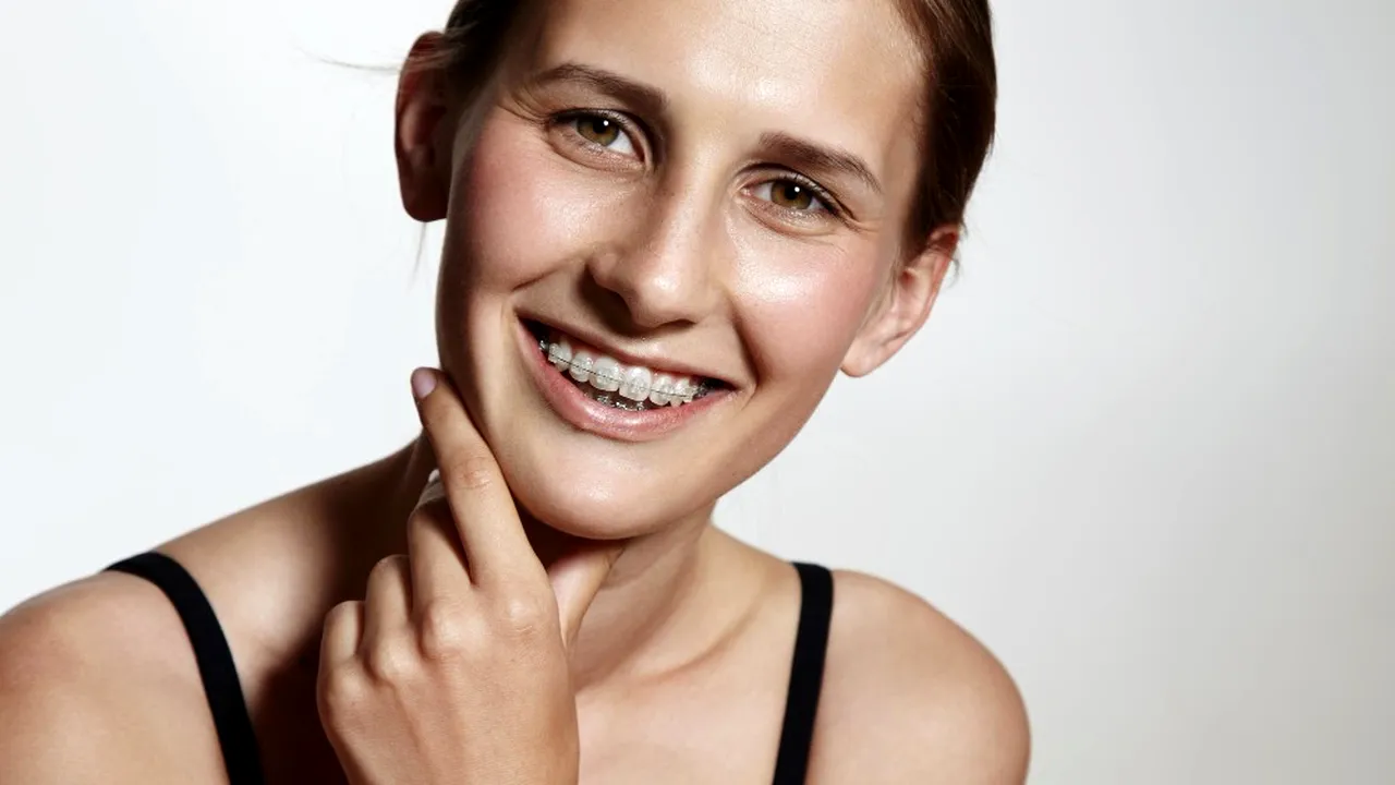 (P) 4 tratamente dentare pe care le poți face în timp ce porți aparat ortodontic