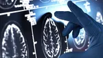 Creierul își „schimbă viteza” de două ori în timpul vieții: la 24 de ani și la 60 de ani. Ce arată analiza a peste 1,3 milioane de celule cerebrale