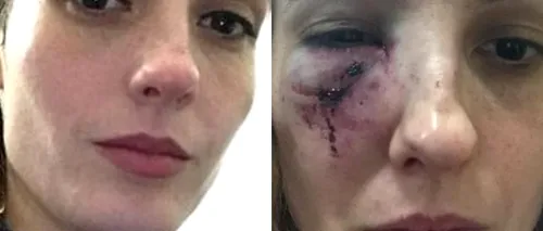 Româncă bătută cu brutalitate de o gașcă de adolescenți britanici. „Au luat foc. Au spus că sunt poloneză și că merit o lecție. Poliția nu a intervenit