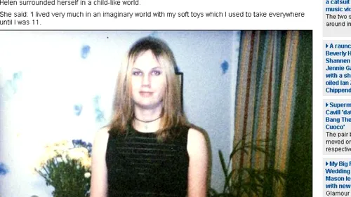 Cum a ajuns să arate o femeie de 30 de ani precum una de 70, din cauza anorexiei