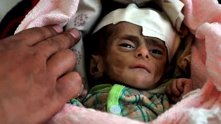IMAGINEA DISPERĂRII: Yemen, țara unde milioane de oameni mor de foame, iar politicienii cer VOTURI CONTRA HRANĂ
