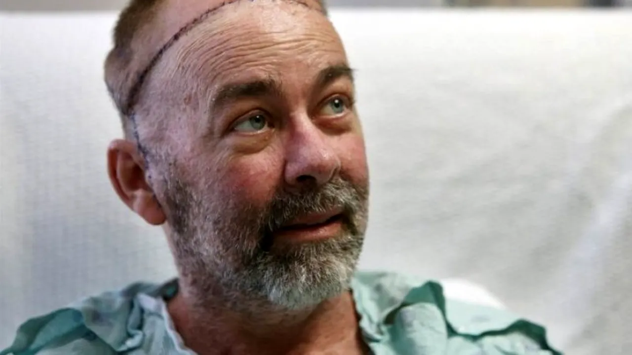 Premieră în lumea medicală. Primul transplant de craniu și de scalp a fost făcut în Statele Unite