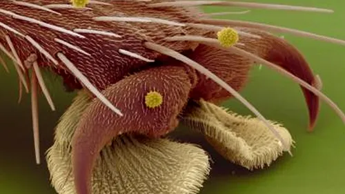 Cum se văd la microscop o banană, piciorul unei muște sau un fir de păr. ''Din așa ceva sunt făcute coșmarurile'