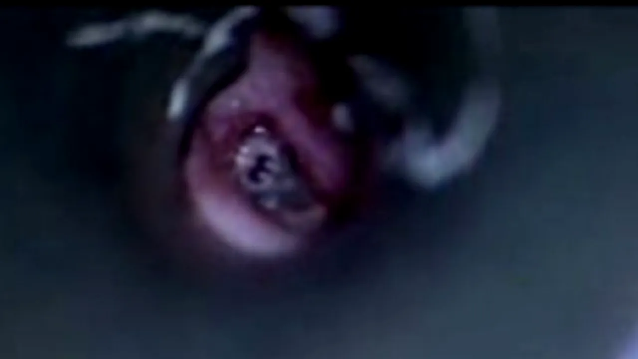 Motivul ieșit din comun pentru care o tânără s-a ales cu migrene insuportabile după ce s-a întors din vacanță. VIDEO