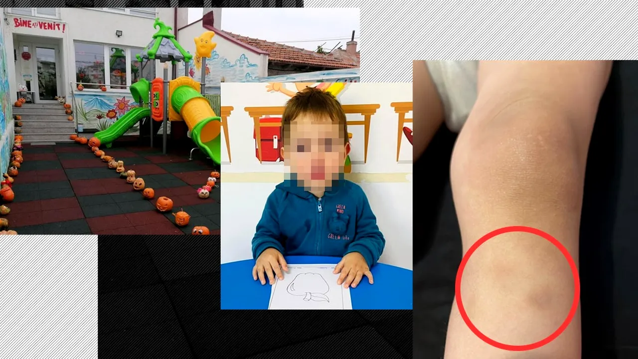 Acuzații TERIFIANTE la adresa unei educatoare de la o creșă din Constanța. ”Băiatul era plin de vânătăi și avea urme de unghii de femeie în mânuță”