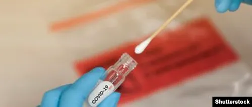 Numărul cazurilor de îmbolnăvire cu coronavirus rămâne ridicat. În ultimele 24 de ore, au fost înregistrate alte 413 noi cazuri de îmbolnăvire din 6.655 de teste efectuate/ La nivel național, au fost prelucrate 854.241 de teste