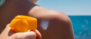 Sfaturi pentru a scăpa rapid de ARSURILE solare. Un important pas în lupta pentru prevenirea cancerului de piele